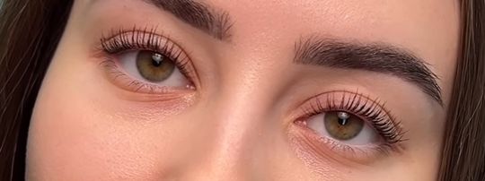 Pós leitourgeí éna lifting vlefarídon nanolash